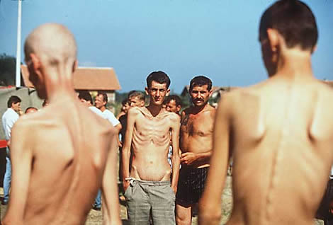 Koncentracijski Kamp Trnopolje u Prijedoru